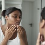Is It Really That Bad to Pop Your Pimples?